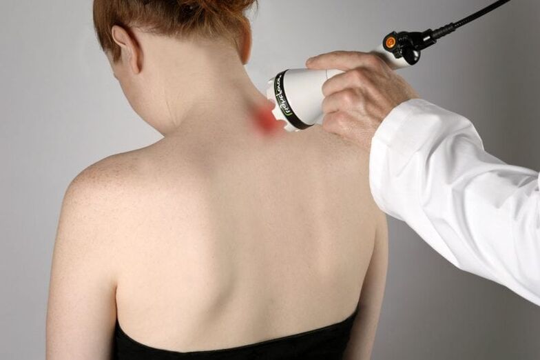 Tratamentul cu laser al osteocondrozei cervicale la femei